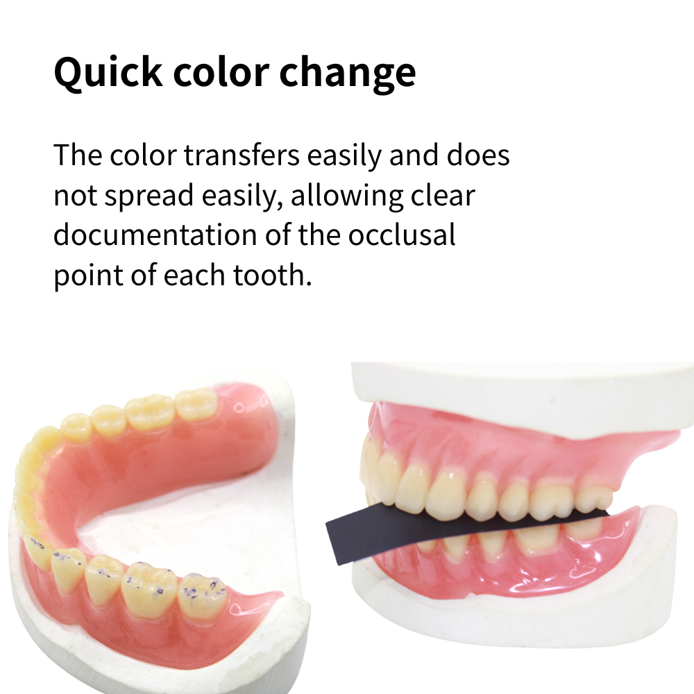 AG 300매/박스 치과용 교합지 레드/블루 치과 기공 - Teeth Whitening Strips 리뷰 및 가격