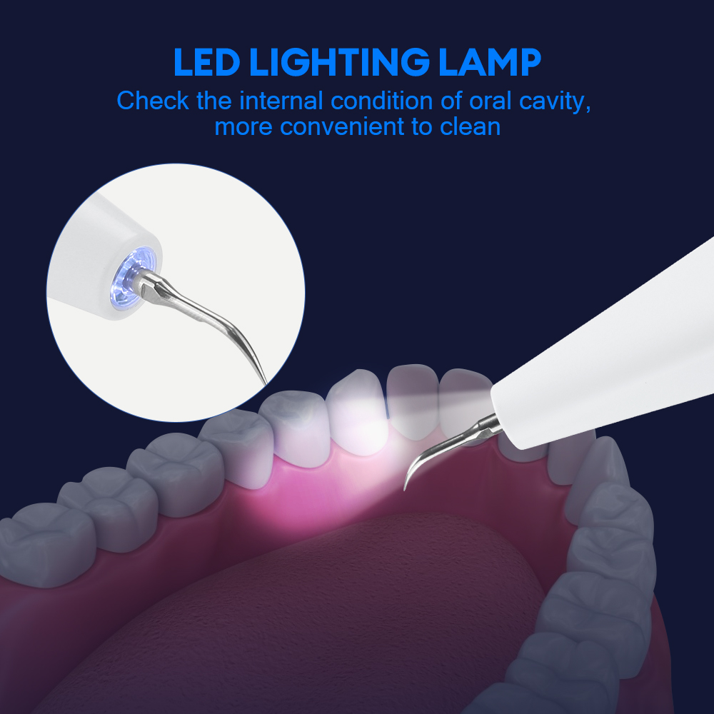 초음파 치과 미적분 제거제 및 9D 치아 미백 스트립  - Teeth Whitening Strips 리뷰 및 가격